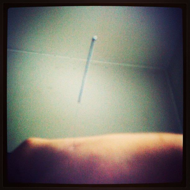 2013/09/09 — 针灸